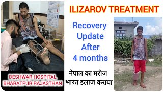 ILIZAROV TREATMENT RECOVERY UPDATE AFTER 4 MONTHS नेपाल से भारत इलाज कराने आया था tibia fracture [upl. by Olegnad]