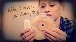 Adding Frames to Your Ostomy Bag  Ostomonday [upl. by Aland20]