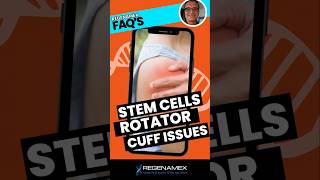 🦾 Can Stem Cells Heal a Rotator Cuff Tear Discover the NonSurgical Solution 🌟 [upl. by Hanford493]