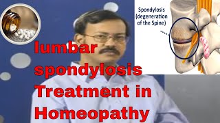 Lumbar Spondylosis  lumbar spondylosis and treatment in homeopathy Treat Back Pain spondylosis [upl. by Onitnelav]