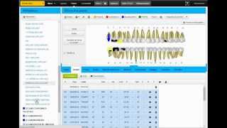 La CCAM cest facile avec ecooDentist [upl. by Cosimo]