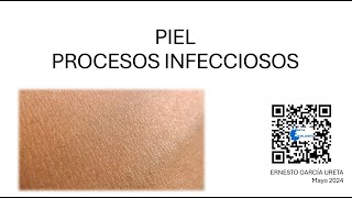 Citología de “Piel – Procesos Infecciosos” [upl. by Intyre]