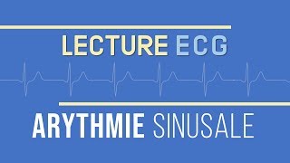 Interprétation ECG  Arythmie Sinusale [upl. by Loseff34]