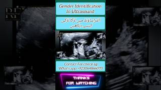 Gender Identification Ultrasound Short [upl. by Ennovahs866]