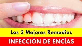 Qué Es Bueno Para La Infección De Las Encías 3 Mejores Remedios [upl. by Eenad113]