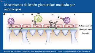 Enfermedades Glomerulares primarias y secundarias [upl. by Stutman]