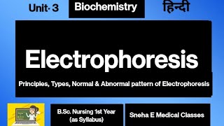 Electrophoresis Principles of Electrophoresis Normal and abnormal Pattern of Electrophoresis [upl. by Wengert]