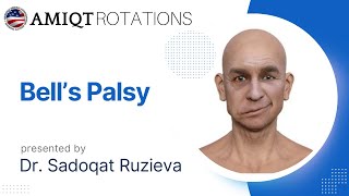 Bells Palsy by Dr Sadoqat Ruzieva [upl. by Ahtennek17]