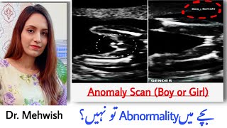 pregnancy ki ultrasound report kaise pade  placenta se jane ladka ya ladki  mommy expertise [upl. by Dorthea]