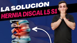 HERNIA DISCAL L5 S1 El MEJOR TRATAMIENTO 💯 Fergallar [upl. by Burnie]