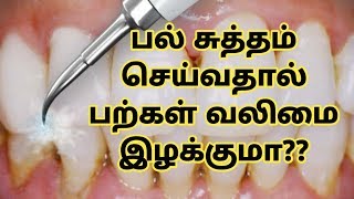 Does scalingTeeth cleaning of teeth make teeth weak  Facts and myths  DrSandhya  Tamil [upl. by Eelinnej109]