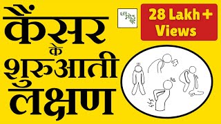 Common cancer signs Hindi Cancer Ke Shuruati Lakshan  Cancer early signs hindi [upl. by Eiderf]