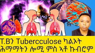 TBን Tubercculose ካልኦት ሕማማትን ሎሚ ምስ ኣቶ ኩብሮም [upl. by Yoreel704]