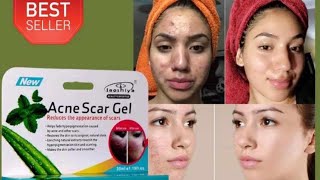 Acne Scar GelAcne and acne scar removal creamRemoves small black spots and smooths the face cream [upl. by Eecyal616]