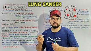 Lung Cancer Stages of cancer Causes Symptoms and treatment [upl. by Anwahsat]