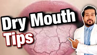 How to Treat Dry Mouth  Xerostomia Fix 2021 [upl. by Yentyrb]