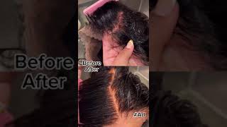 Undetectable wigs are easy with this expert wig knot lightening tutorial BW2plus wigs ClairolPro [upl. by Agathe466]