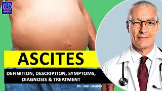 ASCITES Definition Description Causes and symptoms Diagnosis amp Treatment of Ascites [upl. by Phaidra]