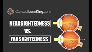 Nearsightedness Vs Farsightedness and the Difference Between the Two [upl. by Nnanaej780]