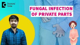 FUNGAL INFECTION OF PRIVATE PARTS Groin InfectionYeast InfectionDrRajdeep MysoreDoctors Circle [upl. by Thorne]