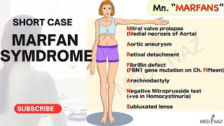 MARFAN SYNDROMESHORT CASECLINICAL EXAMINATION [upl. by Alomeda]