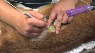 Removing Sebaceous Adenoma [upl. by Nydia]