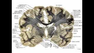 Neuropathology101Basic Neurohistology and NonNeoplastic lesionsmov [upl. by Nnewg259]