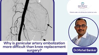 Why is genicular artery embolization more difficult than knee replacement surgery [upl. by Dode]