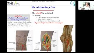 bloc moteur partie 3 MI [upl. by Enaek881]