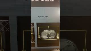 MRI Abdomen Exam diagnosticradiology radiology science mri mrimachine mritech [upl. by Dupre]