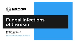 Fungal infections of the skin [upl. by Anaxor]