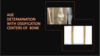 AGE DETERMINATION WITH OSSIFICATION CENTRES OF BONES [upl. by Eudoxia905]