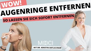 Augenringe sofort entfernen mit Hyaluronsäure [upl. by Erick]