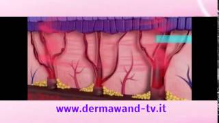 Dermawand video ufficiale [upl. by Aihsele715]