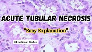 Acute tubular necrosis  Renal pathology mediumrobbins emotionalmedico [upl. by Arihsak400]