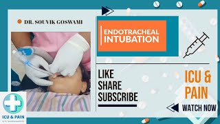 How to Perform Endotracheal Intubation A Clinical Demonstration [upl. by Alraep]