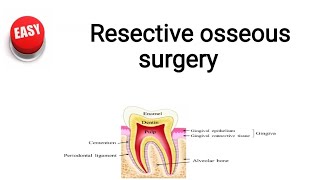 Resective osseous surgery [upl. by Zealand]