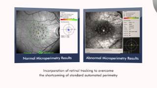 The Optos OCT SLO Imaging System for Retinal Analysis [upl. by Solitta]