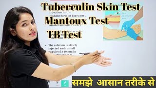 Tuberculin Skin Test  Mantoux Test  Mantoux Test in hindi  TB Test [upl. by Lunt350]