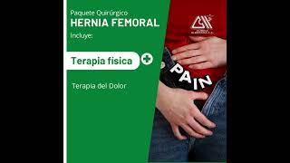 hernia femoral [upl. by Ainer92]