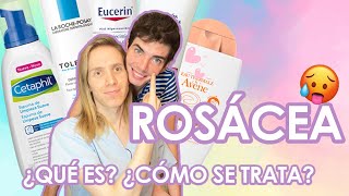 ¿Qué es la ROSACEA ¿Cómo se trata  Productos que recomiendo [upl. by Clarine809]