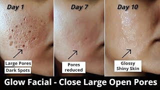 4 Step Glow Facial  Close Large OPEN PORES Remove DARK SPOTS amp get Glowing Skin  Aloevera icecube [upl. by Reivilo]