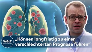 CORONASTUDIE Auch leichte bis mittlere Infektionsverläufe beeinträchtigen Organfunktionen [upl. by Gilbert]