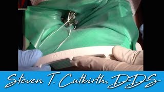 Quick and Easy Rubber Dam Placement  Dental Minute with Steven T Cutbirth DDS [upl. by Gerik]