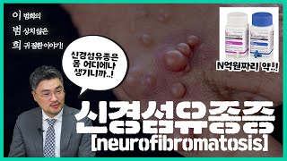 월간 이범희 Ep1 커피반점이 보이면 의심하라 신경섬유종증 [upl. by Couq639]