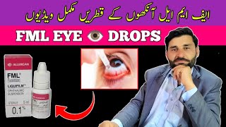 FML EYE drop  eye drop  conjunctivitis treatment  dry eye treatment  ankhon ka drop  fml eye [upl. by Alton]