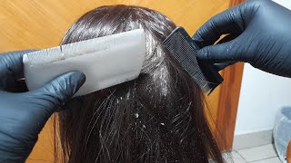 ASMR💫dandruff scratching relaxing scalp cleaning removalbig flakesmannequin [upl. by Ailimat]