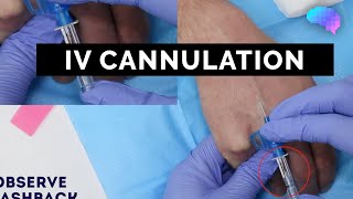 Intravenous IV cannulation  OSCE Guide  UKMLA  CPSA [upl. by Placeeda805]