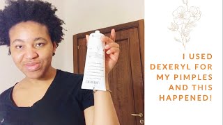 Can Dexeryl combat acne or pimple Yes or No [upl. by Fai201]