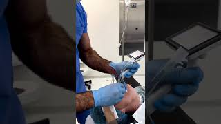 Intubation procedure ytshorts awareness doctor [upl. by Knowling]